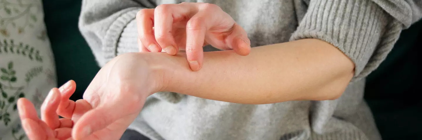 Kratzen an der Hand