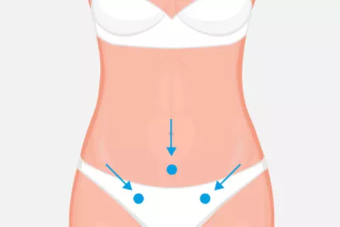 Grafik für eine Akupressur bei Menstruationsbeschwerden