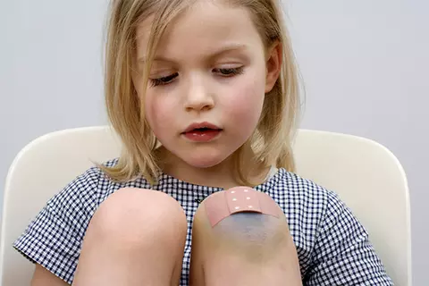 Kind hat am Knie eine Verletzung