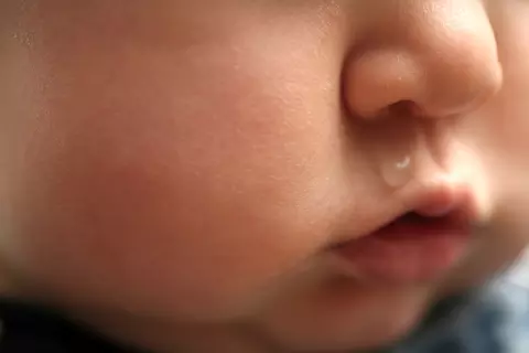 Einem Baby läuft die Nase