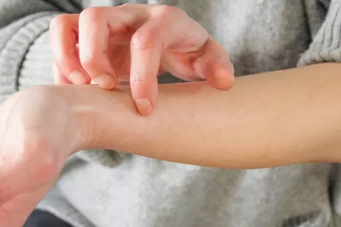 Kratzen an der Hand
