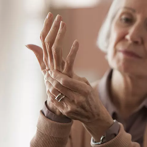 Ältere Dame hat Arthritis in den Händen
